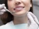 Le blanchiment Dentaire Express en 1H Avec IMSA ♦️ CURES APOLLON BIOHEALTH DE BIEN ÊTRE INTERNATIONAL MEDICAL SERVICE AGENCY