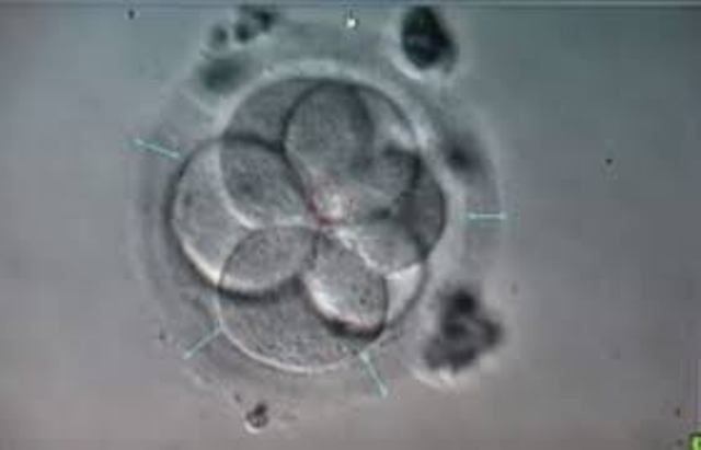 Embryon 4 cellules