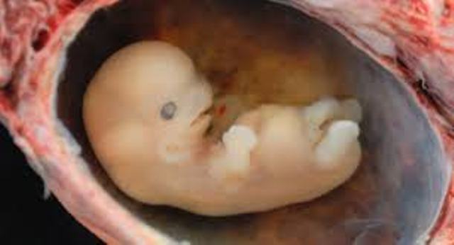 Foetus 9 semaine s de grossesse