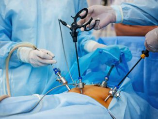 Chirurgie Laparoscopique (coelioscopie) - IMSA