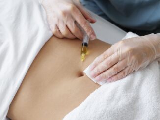 Lipofilling : Greffe de graisse par injection LIPOFILLING MAMMAIRE INTERNATIONAL MEDICAL SERVICE AGENCY