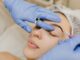 Chirurgie des sourcils : Intervention de Lifting Temporal​ CHIRURGIE DE VISAGE | CHIRURGIE ESTHÉTIQUE | ESTHÉTIQUE INTERNATIONAL MEDICAL SERVICE AGENCY