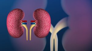Chirurgie urologique - IMSA